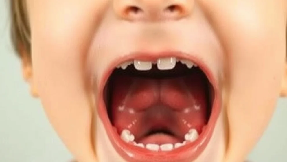 Blåsor i munnen hos barn - vad gör du?